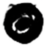 Right Eye